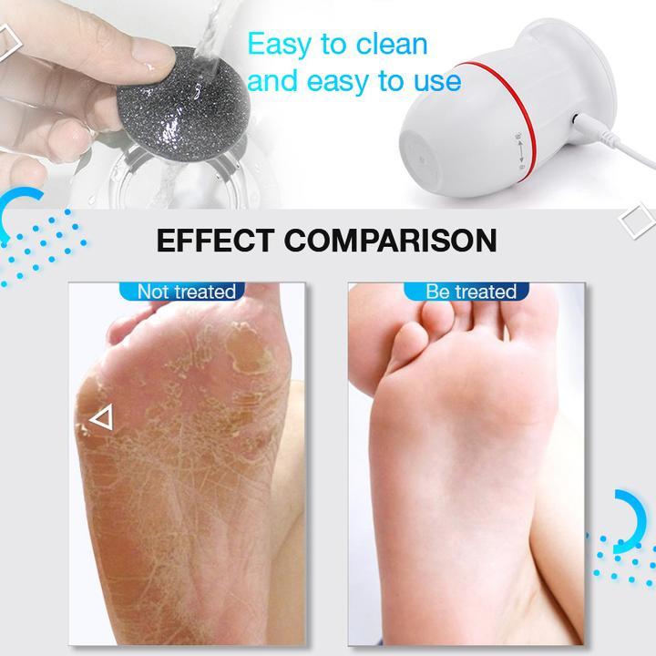 Electric Vacuum Cleaner Foot Grinder