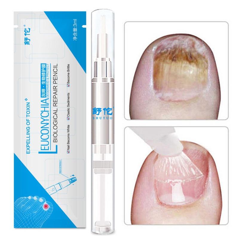 Onychomycosis Nail Repair Pen