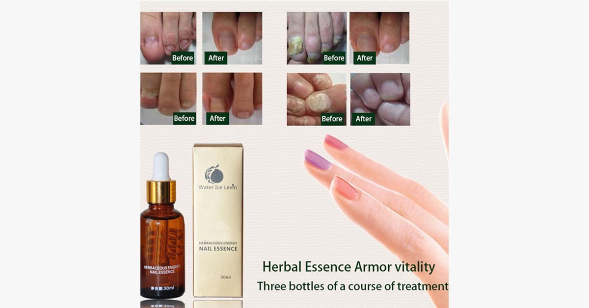 Miracle Nail Essence – The Best Solution for Healthy Nails