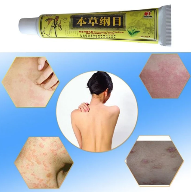 Advanced Psoriasis & Eczema Natural Herbal Cream