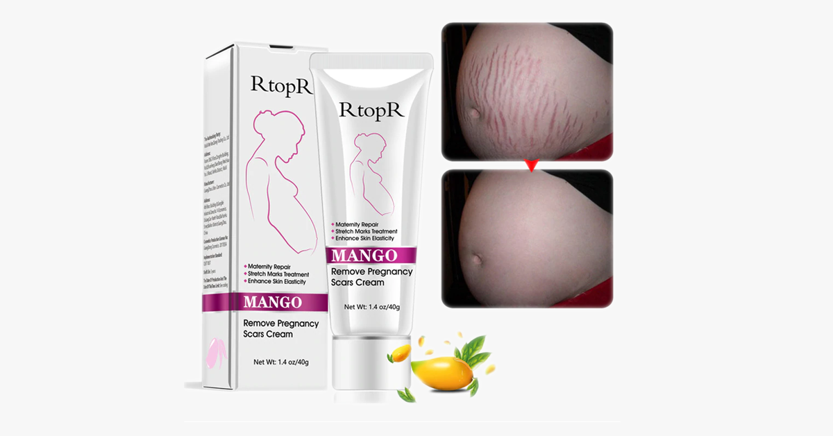 Pregnancy Scars and Stretch Mark Removal Cream
