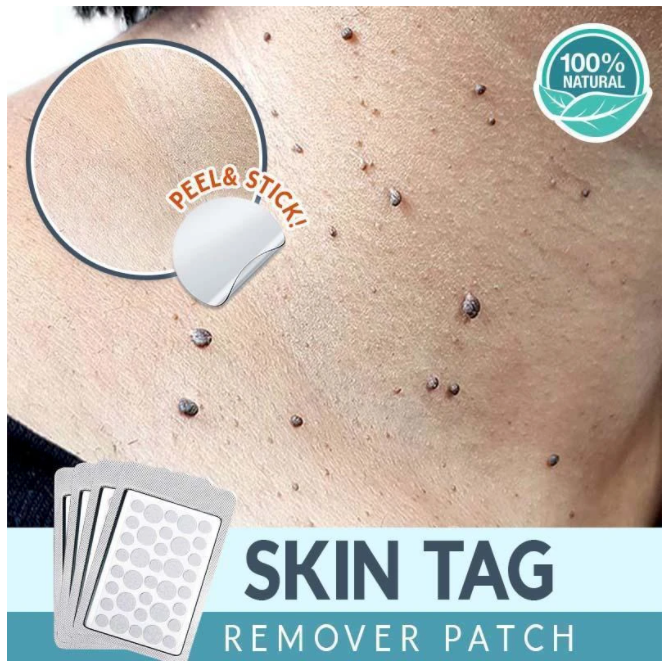 Skin Tag Remover Patches (36 PCS)